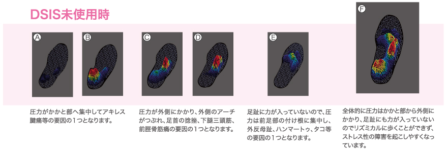 DSIS未使用時