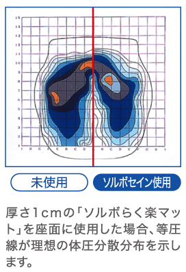 体圧