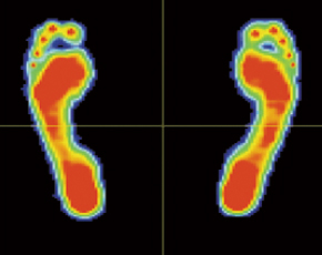 健康な人の足圧